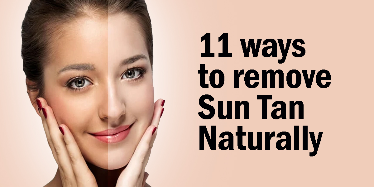 11 Ways to Remove Sun Tan Naturally