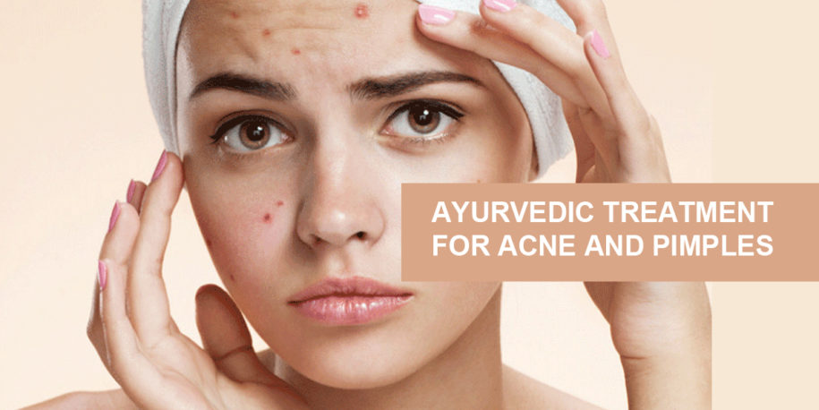 Ayurvedic treatment for Acne Vulgaris - Dr. Brahmanand Nayak