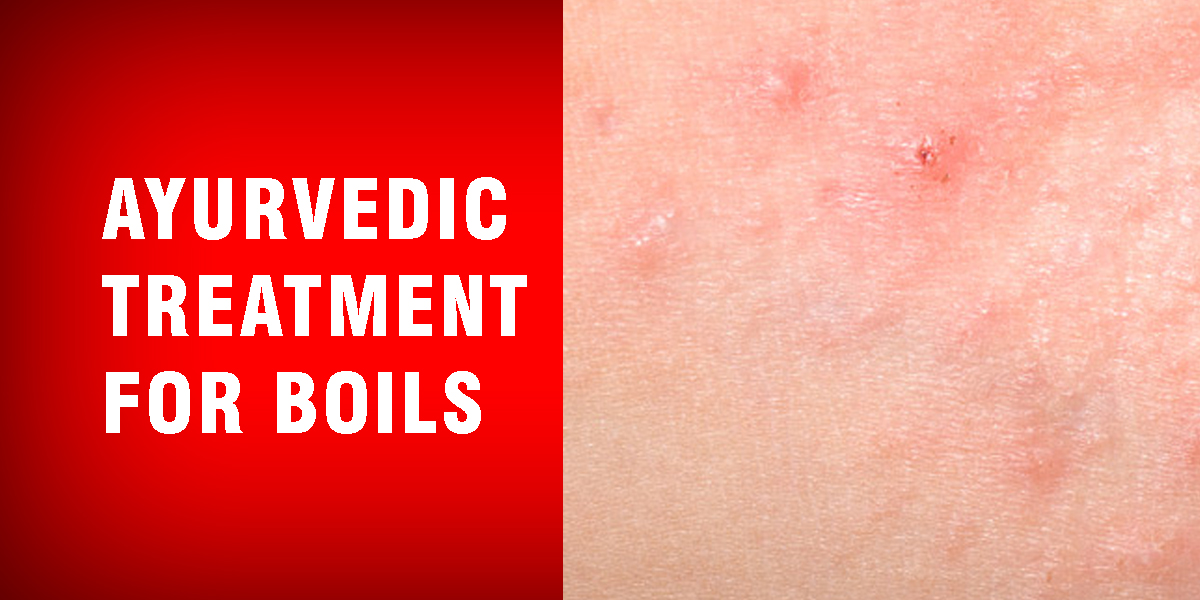 Ayurvedic Treatment For Boils Dr Brahmanand Nayak