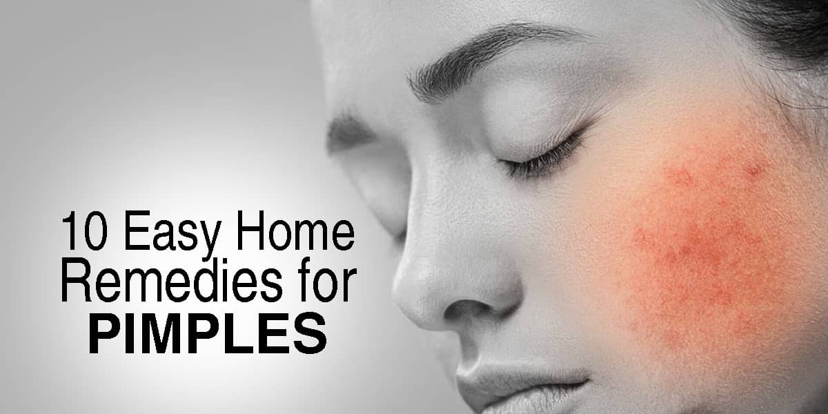 10 Easy Home Remedies for Pimples |  Ayurvedic Doctor’s Recommendations