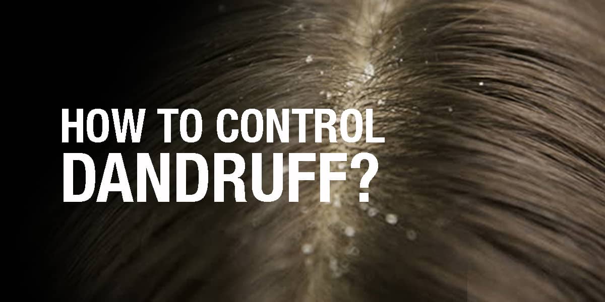 AYURVEDIC HOME REMEDIES FOR DANDRUFF