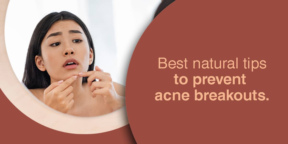 tips to prevent acne