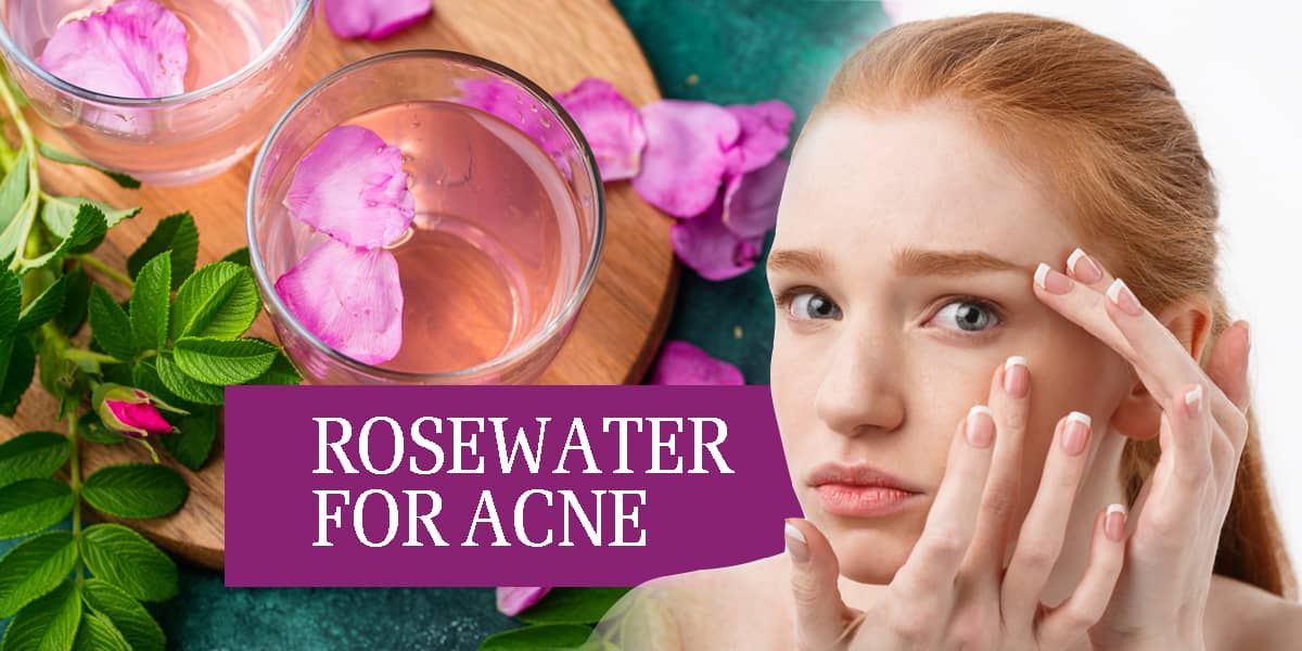 ROSE WATER IN PIMPLE CARE / ACNE CARE