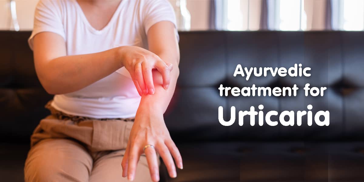 Ayurvedic treatment for Urticaria - Dr. Brahmanand Nayak